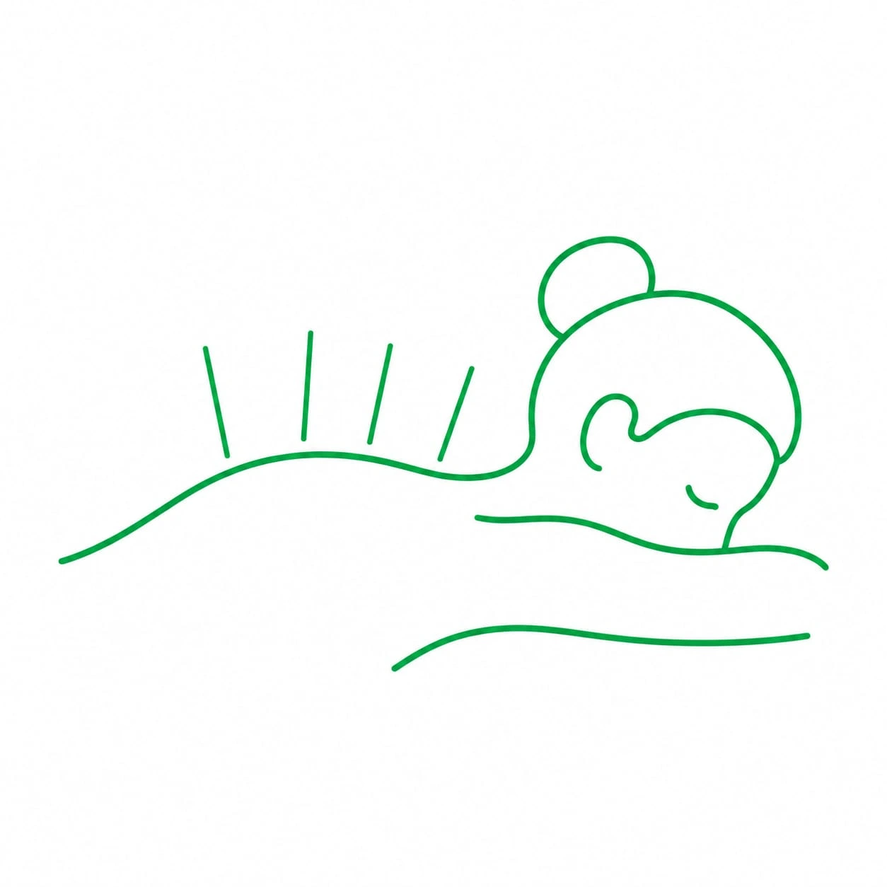 Suche igłowanie (Dry Needling)